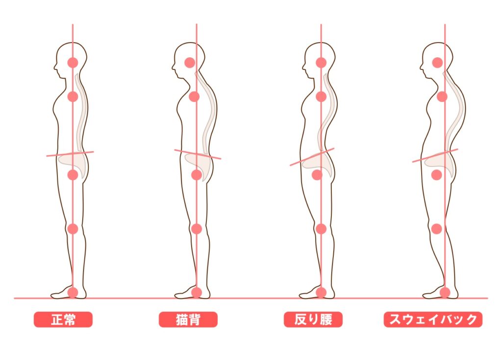 姿勢が崩れていると、筋肉に無駄な負担がかかる